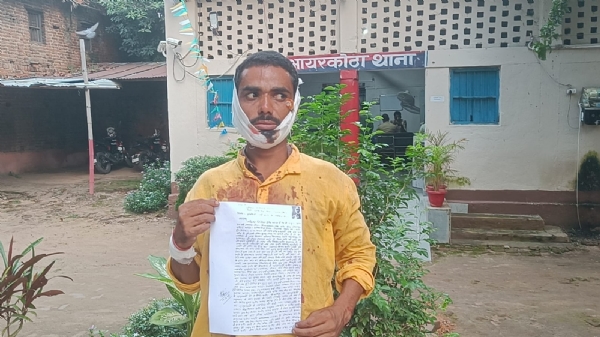 घायल ग्रामीण राहुल की फोटो