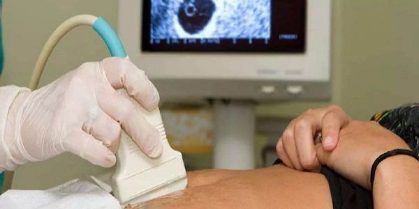 मप्र : सोनोग्राफी सेवाओं के लिए 87 मेडिकल ऑफिसर हुए अधिकृत
