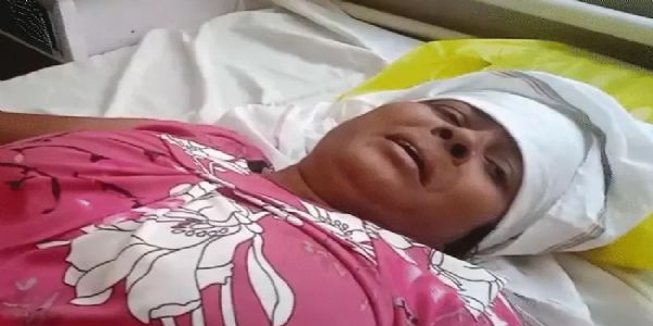मप्रः राजगढ़ में खेत की मेढ़ विवाद में महिला पर फेंका तेजाब, 6 के खिलाफ एफआईआर दर्ज