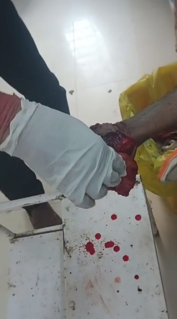 युवक पर तलवार से किया हमला,हाथ में गंभीर जख्म