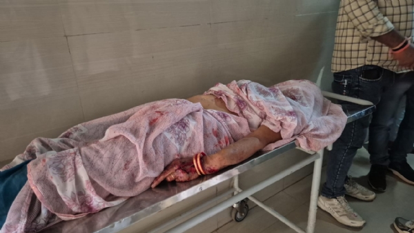 दमोह-भीषण सडक हादसा आटो और बोलेरो की टक्कर एक महिला की मौत दमोह-भीषण सडक हादसा आटो और बोलेरो की टक्कर एक महिला की मौत