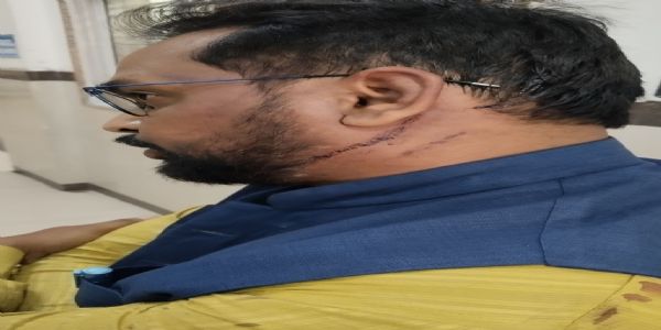 उज्जैनः माधव कॉलेज के प्राध्यापकों के बीच मारपीट