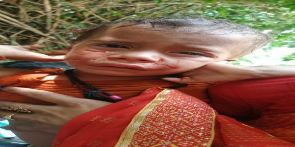 सनकी बंदर ने लोगों का किया जीना मुश्किल ,सत्तर लोग को काटकर घायल कर चुका