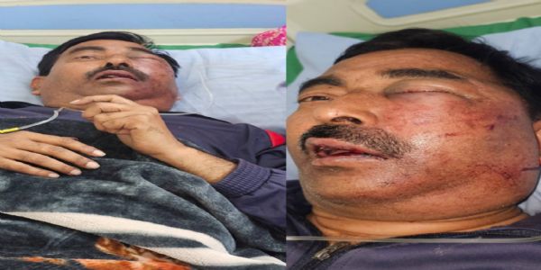 लखनऊ में मान्यता प्राप्त पत्रकार पर हमला, पुलिस ने दर्ज किया केस