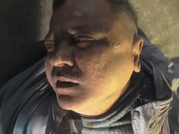 घायल युवक घायल युवक