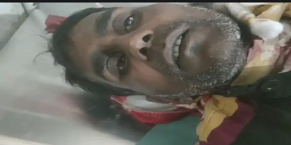 सीतापुर- महोली में मामूली विवाद में गर्दन पर हसिया से हमला