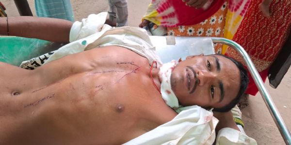 शादी के 15 दिन बाद पत्नी ने पति पर किया ब्लेड से हमला