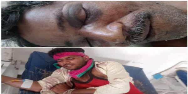 राजगढ़ः पैसों के लेनदेन पर जीजा को उतारा मौत के घाट, भांजे घायल