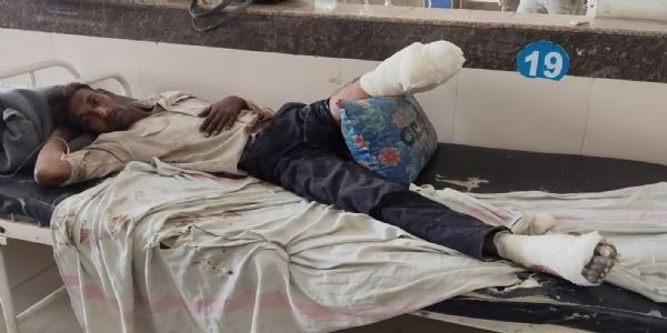 लूट के बाद मजदूर को पटरी पर फेंका, ट्रेन की चपेट में आने से कटा पैर