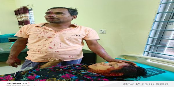 बांग्लादेश