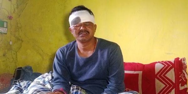 नकाबपोश चोरों ने बन्दूक के बट से मारकर मुखिया को किया घायल