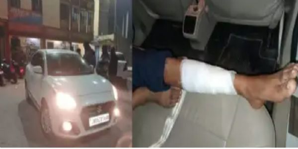 फायरिंग में गोली लगने से युवक घायल