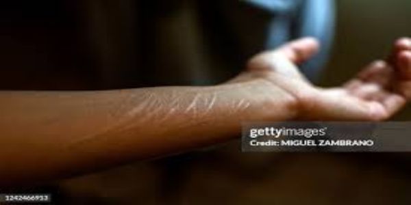 पूछताछ से बचने के लिए थाने में चोर ने किया सुसाइड का नाटक