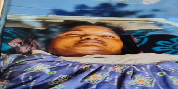 अलाव तापने के दौरान साड़ी में लगी आग, नवविवाहिता की मौत