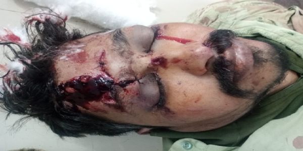 राजगढ़ः अलग-अलग जगह हुए सड़क हादसे में दो व्यक्तियों की मौत