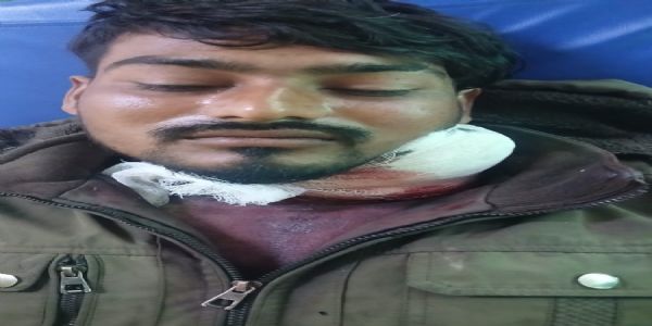 खाना मांगने पर पत्नी ने पति का चाकू से गला रेता