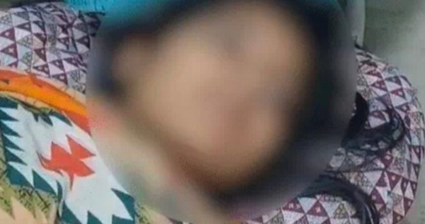 लोहिया अस्पताल में भर्ती पीड़ित लड़की (चेहरा छुपाते हुए फोटो)