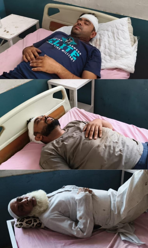 पेड़ लगाने के विवाद पर हुई मारपीट में घायल जिला अस्पताल में भर्ती।