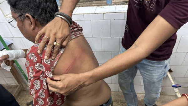 खातरा बाजार में मंत्री के पति पर हमला