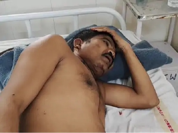 बेटे का अफेयर, पिता को दौड़ा-दौड़ाकर पीटा, अस्पताल में भर्ती, चार पर एफआईआर