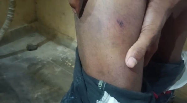 चोट के निशान 1