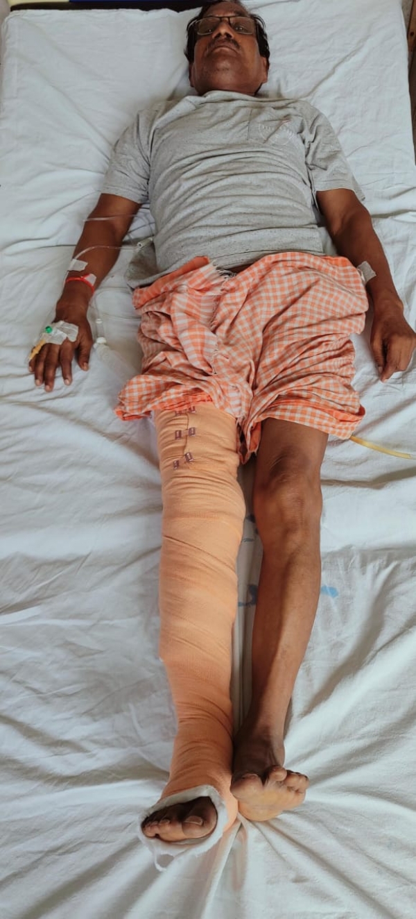 एसआरएन अस्पताल में सफल आपरेशन का छाया चित्र