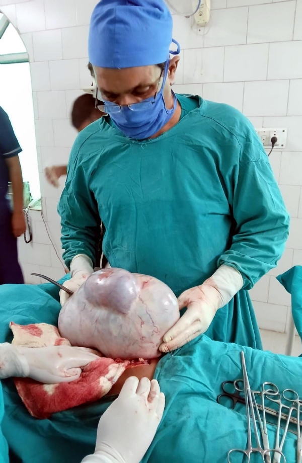 फतेहाबाद। महिला के पेट से रसौली निकालते डॉ. सिवाच।