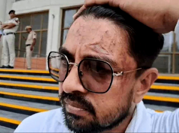नरेंद्र ने आरोप लगाया कि पुलिसकर्मियों ने उसके सिर पर खूब चोट मारी है।