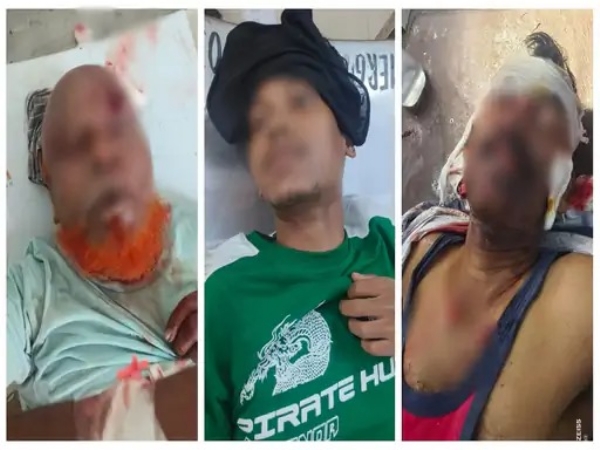नशे में कार सवार युवक  ने 5 लोगों को रौंद दिया, इनमें 3 की मौत, वहीं 3 गंभीर घायल