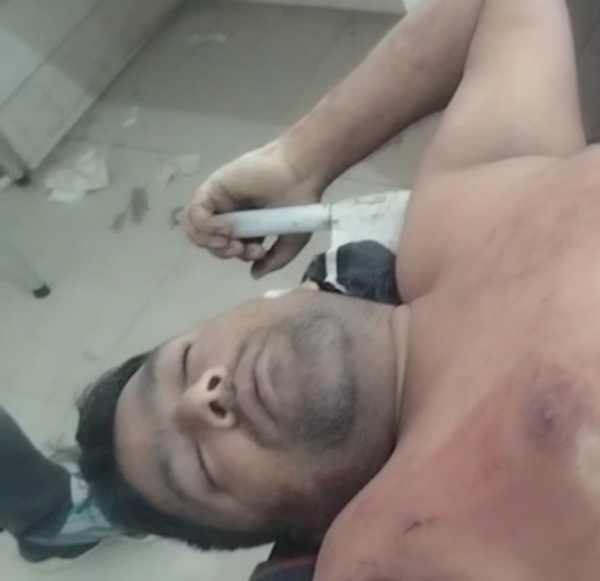 घायल मोहम्मद अंसार की फोटो