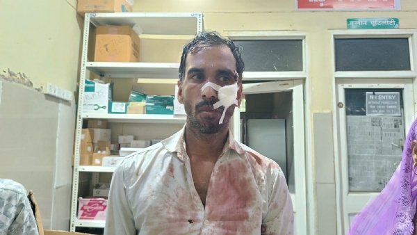 अस्पताल में मौजूद घायल