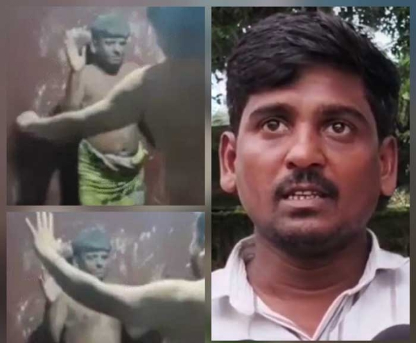 पीड़ित ड्राइवर खुर्शीद अहमद एवं उसकी पिटाई की फाेटाे