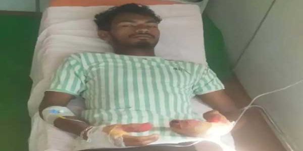 नक्सलियाें के प्रेशर आईईडी विस्फोट से एक ग्रामीण गंभीर रूप से घायल