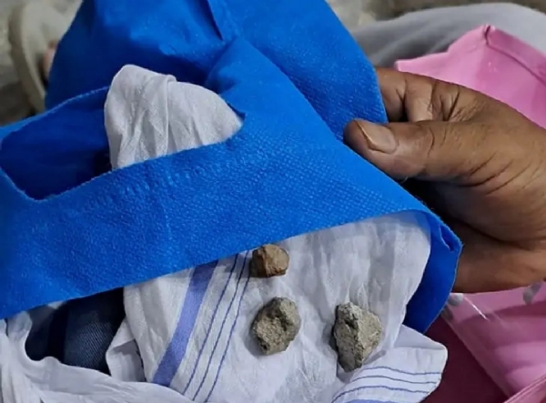 आरोपियों ने महिला को बदले में रुमाल में बंधे पत्थर थमाए और फरार हो गए।