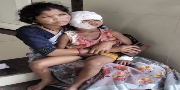जबलपुरः 6 साल की मासूम को आवारा कुत्तों ने नोंचा.. सिर और शरीर पर गहरे जख्म,