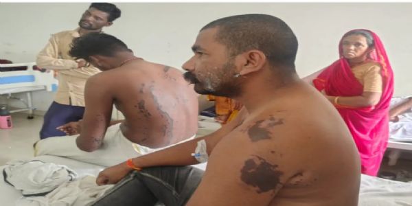 राजगढ़ः कार-बाइक की टक्कर के विवाद पर बाइक सवार पिता-पुत्र ने फेंका एसिड, छह जख्मी