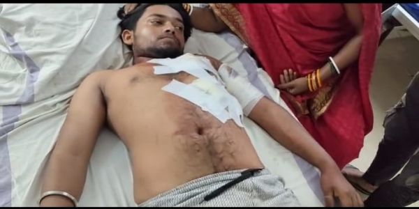 अनूपपुर: पेट्रोल डलवाने के लिए आए युवकों ने कर्मचारी को मारा चाकू, दो गिरफ्तार