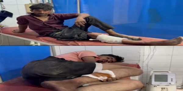 पुलिस और बदमाशों के बीच मुठभेड़, तीन दिन पहले महिला के साथ की थी लूट