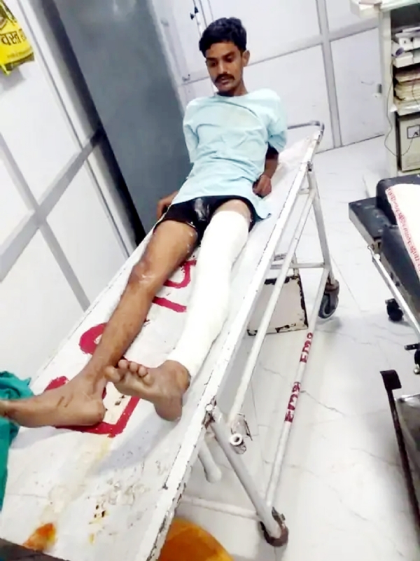 मुठभेड़ में घायल बदमाश।