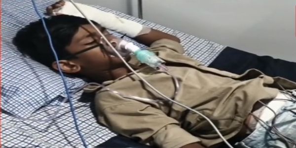 धारः पतंग उड़ाते समय 13 वर्षीय बालक को करंट लगने से बुरी तरह झुलसा