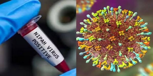 शिल्पा वायरस