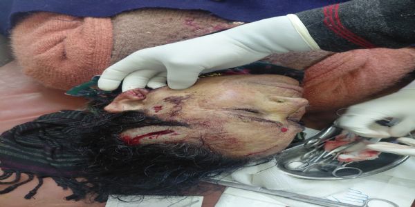 बड़कोट भालू के  हमले में महिला घायल , ग्रामीणों में दहशत