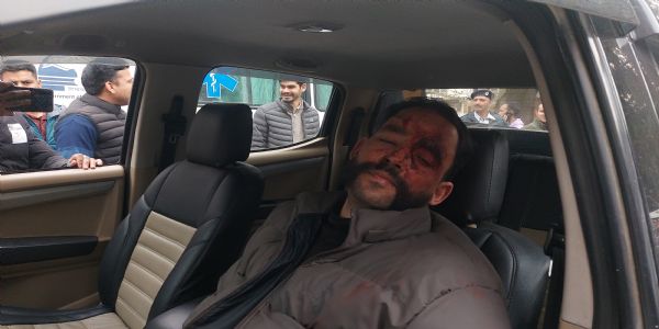 कुल्लू के काईस में भूमि पैमाइश के दौरान पटवारी पर जानलेवा हमला, गंभीर रूप से घायल