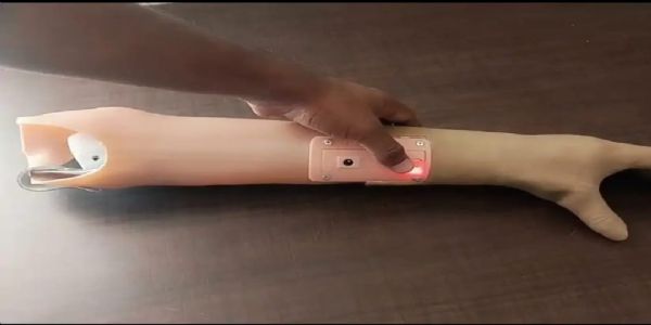 विशेष शिविर में बिना हाथ के दिव्यांगों को लगेंगे निशुल्क इलेक्ट्रॉनिक प्रोस्थेटिक्स हैंड्स