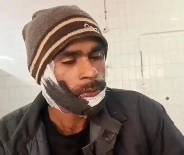 जिला अस्पताल में घायल कैदी