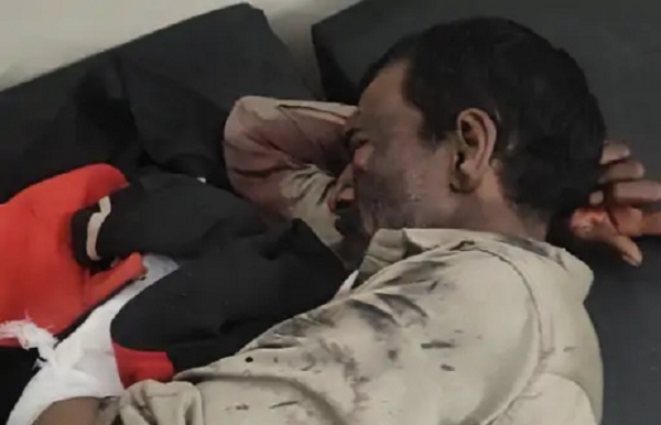 महू में फायरिंग रेंज के पास बम फटने से एक व्यक्ति झुलसा