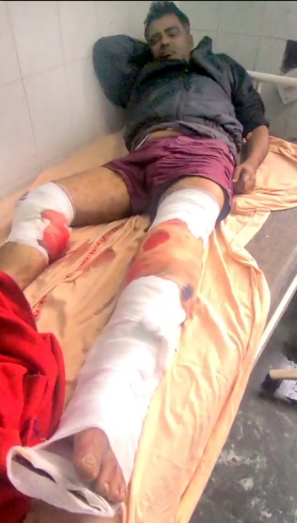 गुरुग्राम-सोहना रोड पर पुलिस मुठभेड़ में गोली लगने से घायल होने पर अस्पताल में उपचाराधीन इनामी बदमाश यादराम।