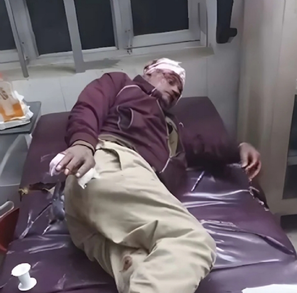 गम्भीर घायल होमगार्ड गम्भीर घायल होमगार्ड