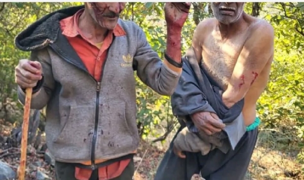 गुलदार के हमले घायल व्यक्ति