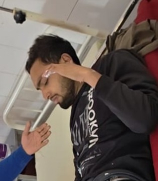 जिला अस्पताल में भर्ती ज्वलनशील पदार्थ से घायल छात्र फरहाद अली। जिला अस्पताल में भर्ती ज्वलनशील पदार्थ से घायल छात्र फरहाद अली।